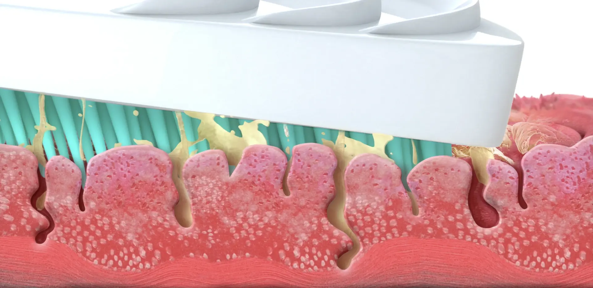  Najlepszy skrobak do języka w teście